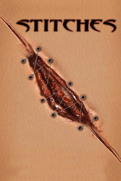 Stitches