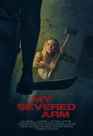 My Severed Arm