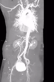 X-Ray Eros