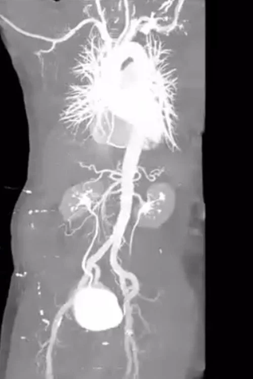 X-Ray Eros