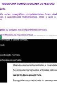 Uma tomografia do meu pescoço