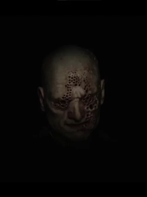 Trypophobia