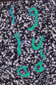 LGFUAD