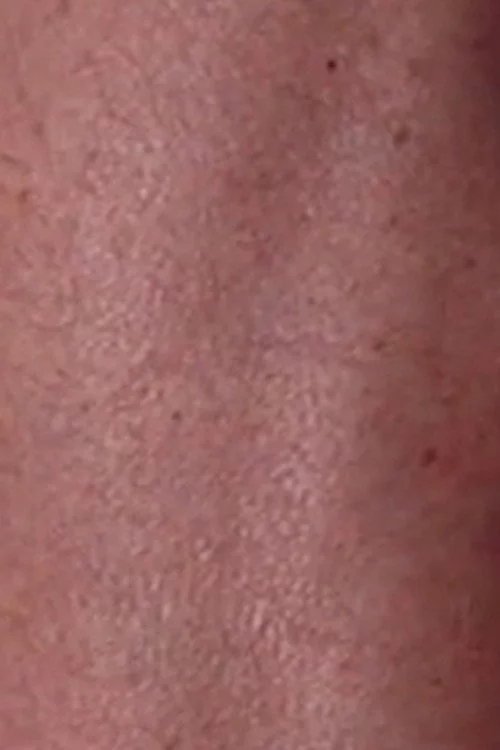 Suite: My Father's Leg