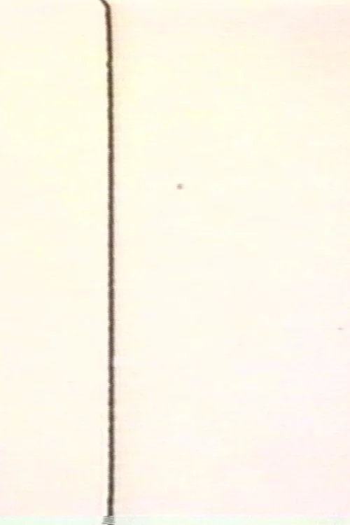 MA (Intervals)